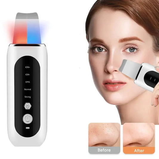 Ultrasonic Face Skin Scrubber Spatula with 5 Modes, Ultrasonic Vibration Peeling