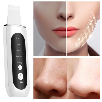 Ultrasonic Face Skin Scrubber Spatula with 5 Modes, Ultrasonic Vibration Peeling